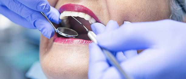 Best Teeth Whitening  in Arnaudville, LA