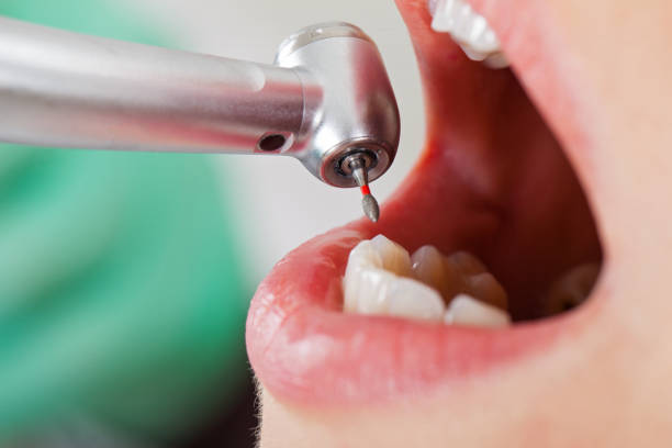 Best Knocked-Out Tooth Emergency  in Arnaudville, LA